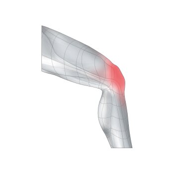 sensiplast® Kniegelenkbandage, mit Anti-Rutsch-Beschichtung (M) - B-Ware neuwertig