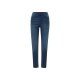 esmara® Damen Jeggings, Slim Fit, normale Leibhöhe (Blau, 36) - B-Ware neuwertig