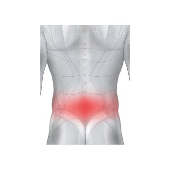 sensiplast® Rückenbandage (L/XL) - B-Ware sehr gut
